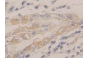 DAB staining on IHC-P; Samples: Human Stomach Tissue (Peroxiredoxin 2 Antikörper  (AA 6-164))