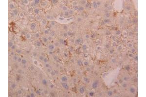 DAB staining on IHC-P; Samples: Human Liver Tissue (Cathepsin D Antikörper  (AA 23-161))