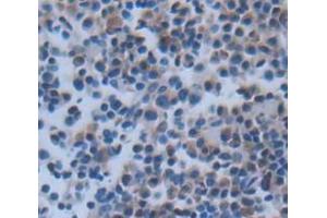 IHC-P analysis of Rat Tissue, with DAB staining. (CMA1 Antikörper  (AA 22-247))