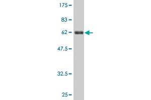 Western Blot detection against Immunogen (63. (BDH1 Antikörper  (AA 1-343))