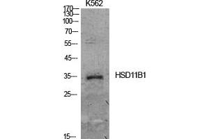 Western Blot analysis of K562 cells using 11β-HSD1 Polyclonal Antibody. (HSD11B1 Antikörper  (N-Term))