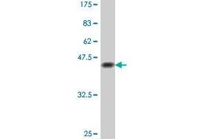 Western Blot detection against Immunogen (38. (SOX9 Antikörper  (AA 400-509))