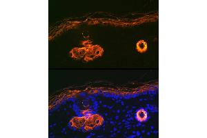 Immunofluorescence analysis of rat skin using Cytokeratin 2e (KRT2) Rabbit mAb (ABIN1680763, ABIN3016322, ABIN3016323 and ABIN7101480) at dilution of 1:100 (40x lens). (Keratin 2 Antikörper)