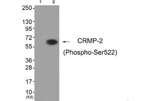 Western blot analysis of extracts from HuvEc cells (Lane 2), using CRMP-2 (Phospho-Ser522) Antibody. (DPYSL2 Antikörper  (pSer522))