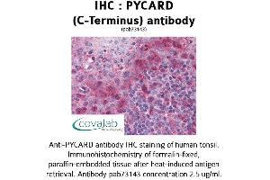 Image no. 2 for anti-PYD and CARD Domain Containing (PYCARD) (C-Term) antibody (ABIN1738638) (PYCARD Antikörper  (C-Term))