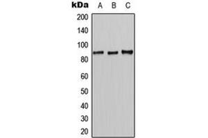 Western blot analysis of CLCN7 expression in HeLa (A), mouse liver (B), rat liver (C) whole cell lysates. (CLCN7 Antikörper  (N-Term))