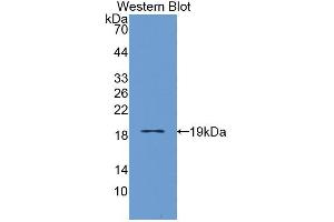 Western blot analysis of the recombinant protein. (IL3RA Antikörper  (AA 19-157))