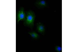 Immunofluorescence (IF) image for anti-Epidermal Growth Factor Receptor (EGFR) antibody (ABIN7127467)