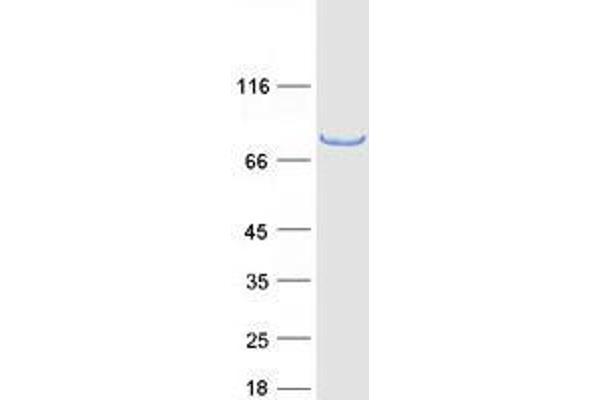 TRIM3 Protein (Transcript Variant 1) (Myc-DYKDDDDK Tag)