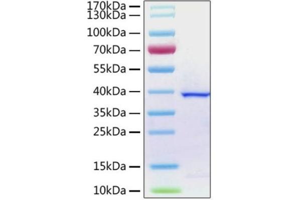 SARS-CoV-2 NSP3 Protein (AA 1564-1878) (His tag)