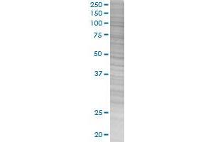 HSD11B1 transfected lysate. (HSD11B1 293T Cell Transient Overexpression Lysate(Denatured))