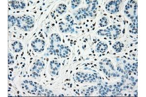 Immunohistochemical staining of paraffin-embedded breast tissue using anti-SSB mouse monoclonal antibody. (SSB Antikörper)