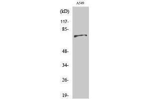 Western Blotting (WB) image for anti-BMX Non-Receptor Tyrosine Kinase (BMX) (Ser182) antibody (ABIN3174045) (BMX Antikörper  (Ser182))