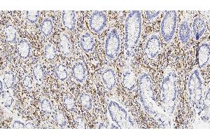 Human tonsil: immunohistochemical staining for CD56. (CD56 Antikörper  (Extracellular Domain))