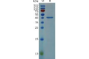 Human RN Protein, mFc Tag on SDS-PAGE under reducing condition. (RNASE4 Protein (AA 29-147) (Fc Tag))