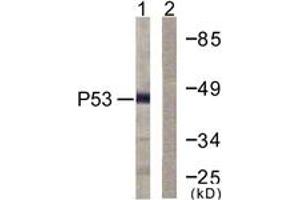 Western blot analysis of extracts from COS7 cells, treated with TSA 400nM 24h, using p53 (Ab-379) Antibody. (p53 Antikörper  (AA 336-385))