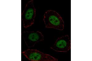 Fluorescent image of  cell stained with MSX1 Antibody (Center) (ABIN1537757 and ABIN2838265). (MSX1 Antikörper  (AA 111-138))
