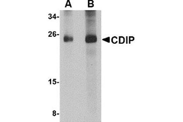 CDIP1 Antikörper  (Middle Region 1)