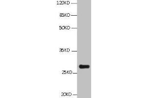 All Lanes:Mouse anti BCL2L1 Monoclonal antibody at 1 μg/mL Lane 1:HepG2 whole cell lysate Secondary Goat polyclonal to Mouse IgG at 1/5000 dilution Predicted band size:26,27,19kd Observed band size:26KD (BCL2L1 Antikörper)