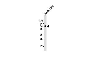 Anti-AFP Antibody at 1:2000 dilution + human fetal Liver lysate Lysates/proteins at 20 μg per lane. (alpha Fetoprotein Antikörper  (AA 281-609))