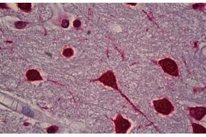 Anti-FOS / c-FOS antibody IHC staining of human brain, cortex. (c-FOS Antikörper)