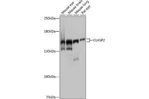 Western blot analysis of extracts of various cell lines, using CL antibody (ABIN1679249, ABIN3019015, ABIN3019016 and ABIN6220674) at 1:1000 dilution. (CLASP2 Antikörper  (AA 220-400))