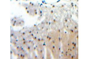 Used in DAB staining on fromalin fixed paraffin-embedded Brain tissue (CENPI Antikörper  (AA 321-579))