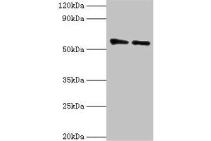 Western blot All lanes: OXCT1 antibody at 8 μg/mL Lane 1: Mouse heart tissue Lane 2: Mouse kidney tissue Secondary Goat polyclonal to rabbit IgG at 1/10000 dilution Predicted band size: 57, 14 kDa Observed band size: 57 kDa (OXCT1 Antikörper  (AA 261-520))