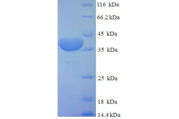 FKBP14 Protein (AA 20-211) (His-SUMO Tag)