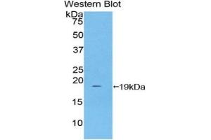 Western Blotting (WB) image for Haptoglobin (HP) ELISA Kit (ABIN6574215)