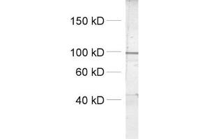 dilution: 1 : 1000, sample: crude synaptosomal fraction of rat brain (P2) (Dynamin 1, 2, 3 (AA 2-17) Antikörper)