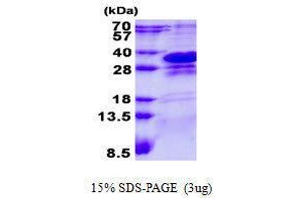 CHMP1A Protein