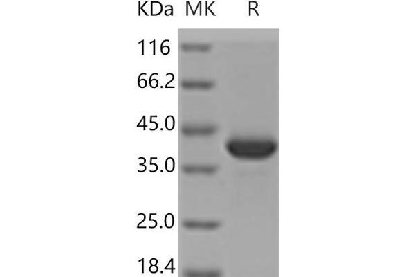 MDH1 Protein (His tag)