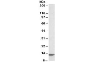 Western blot testing of human duodenum lysate with B2M antibody at 0. (beta-2 Microglobulin Antikörper)