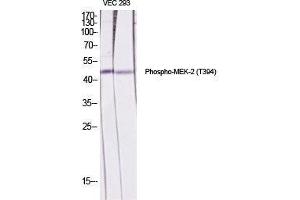 Western Blot (WB) analysis of specific cells using Phospho-MEK-2 (T394) Polyclonal Antibody. (MEK2 Antikörper  (pThr394))