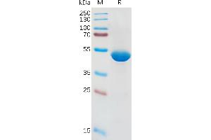 Human IL1B Protein, hFc Tag on SDS-PAGE under reducing condition. (IL-1 beta Protein (AA 117-269) (Fc Tag))