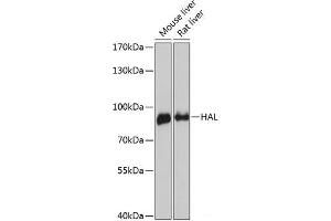 Western blot analysis of extracts of various cell lines using HAL Polyclonal Antibody at dilution of 1:3000. (HAL Antikörper)