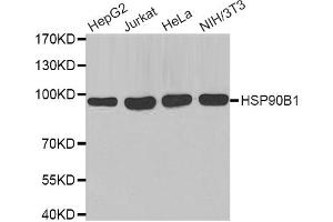 Western blot analysis of extracts of various cell lines, using HSP90B1 antibody (ABIN2968872). (GRP94 Antikörper)