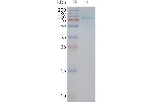 Human R-Nanodisc, Flag Tag on SDS-PAGE (UTS2R Protein)