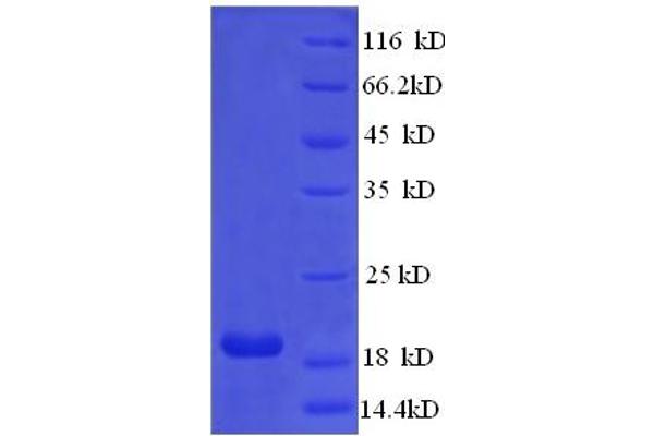 MSH2 Protein (AA 139-311) (His tag)