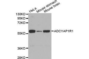 Western Blotting (WB) image for anti-Adenylate Cyclase Activating Polypeptide 1 (Pituitary) Receptor Type I (ADCYAP1R1) antibody (ABIN6220077) (ADCYAP1R1 Antikörper)