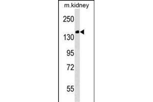Mouse Casc5 Antibody (C-term) (ABIN1536748 and ABIN2838238) western blot analysis in mouse kidney tissue lysates (35 μg/lane). (CASC5 Antikörper  (C-Term))