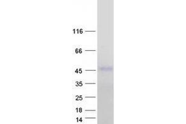 ZFYVE27 Protein (Transcript Variant 6) (Myc-DYKDDDDK Tag)