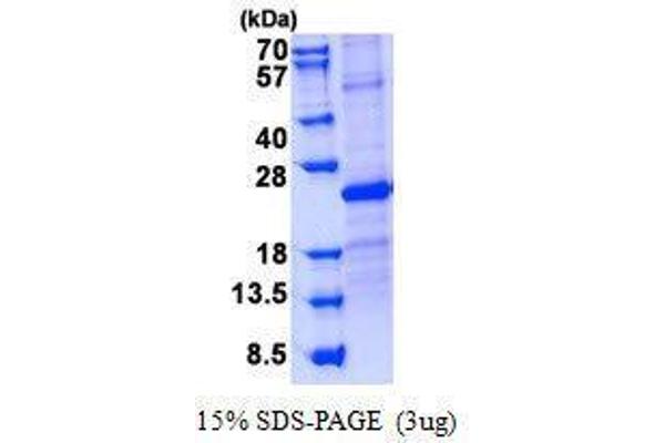 SOSTDC1 Protein