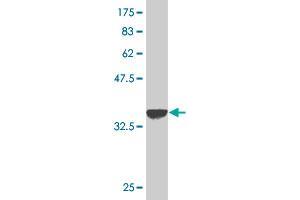 Western Blot detection against Immunogen (37. (Keratin 10 Antikörper  (AA 345-454))