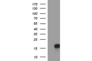 Image no. 1 for anti-SIVA1, Apoptosis-Inducing Factor (SIVA1) antibody (ABIN1500939) (SIVA1 Antikörper)