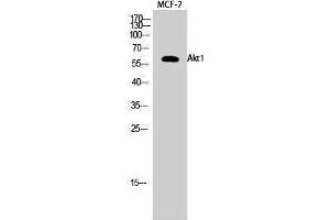 Western Blotting (WB) image for anti-V-Akt Murine Thymoma Viral Oncogene Homolog 1 (AKT1) (Ser137) antibody (ABIN6284493) (AKT1 Antikörper  (Ser137))