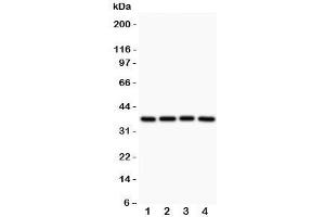Western blot testing of MCL1 antibody and Lane 1:  rat spleen;  2: human HEPG2;  3: (h) MCF-7;  4: (h) COLO320 (MCL-1 Antikörper  (AA 1-350))