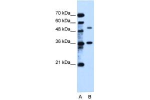 C9ORF127 antibody used at 2. (TMEM8B Antikörper  (C-Term))