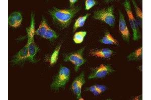 Immunofluorescence of HeLa cells showing strong punctate cytoplasmic labeling of LAMP1 corresponding to lysosomes and late endosomes in red. (LAMP1 Antikörper)